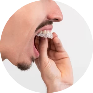odontologia, dentista, alinhador estético, tratamento dentário,